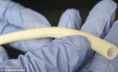 The DIY veins that could transform heart surgery