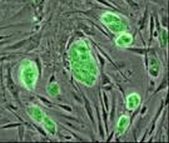 Liquid polymer research could represent next breakthrough in stem cell therapy