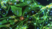 Breakthrough in delivering drugs to the brain