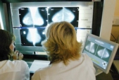 Breast cancer breakthrough